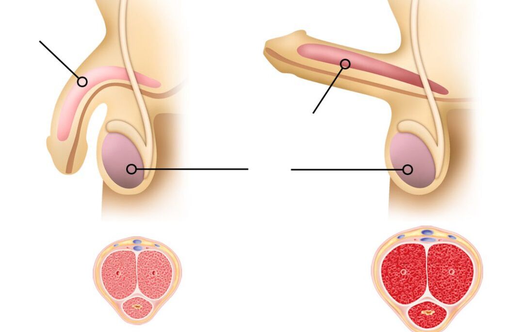 causes of decreased potency in men